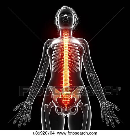 Back pain, artwork View Large Illustration Stock Illustration - Back pain, artwork. Fotosearch