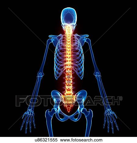 Back pain, artwork View Large Illustration Stock Illustration - Back pain, artwork. Fotosearch