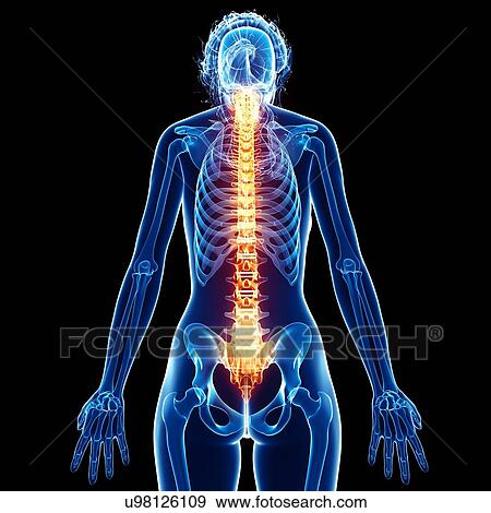 Stock Illustration - Back pain, artwork. Fotosearch