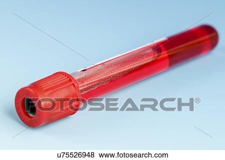 Stock Illustration - Blood sample. Fotosearch