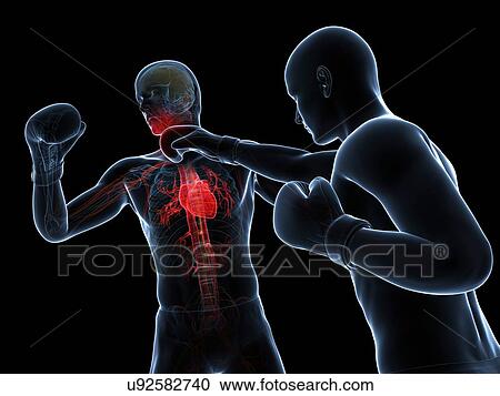 Clipart - Boxing match, artwork. Fotosearch