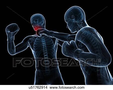 Stock Illustration - Boxing match, artwork. Fotosearch