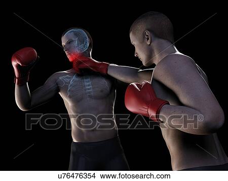 Stock Illustration - Boxing match, artwork. Fotosearch