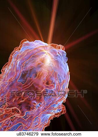 Stock Illustration - Cancer treatment, artwork. Fotosearch
