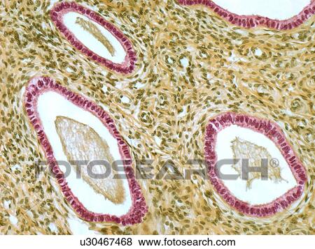 Cervix, light micrograph View Large Illustration Stock Illustration - Cervix, light micrograph. Fotosearch