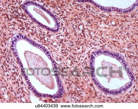Cervix, light micrograph View Large Illustration Stock Illustration - Cervix, light micrograph. Fotosearch