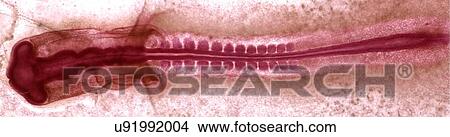 Stock Illustration - Chicken embryo, light micrograph. Fotosearch