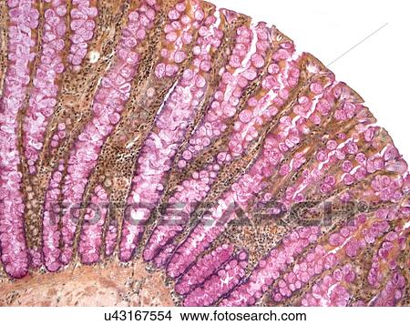 Stock Illustration - Colon, light micrograph. Fotosearch