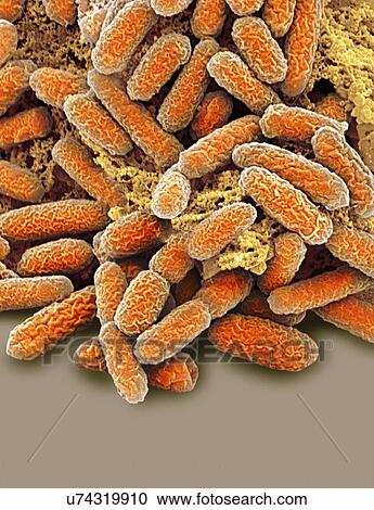 Clipart - E coli bacteria, SEM. Fotosearch