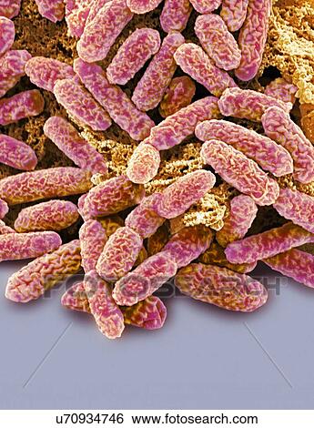 Stock Illustration - E coli bacteria, SEM. Fotosearch