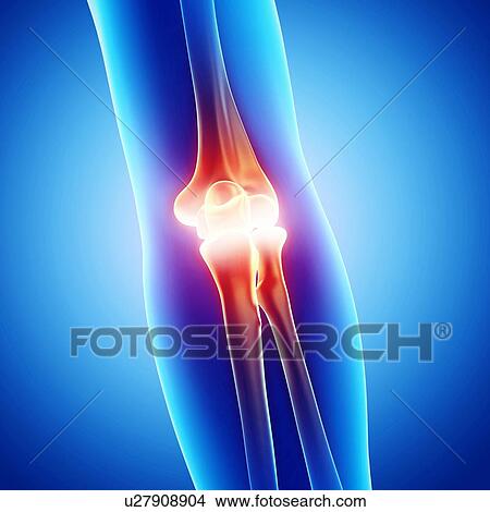 Stock Illustration - Elbow pain, artwork. Fotosearch