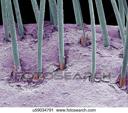 Eyelash mites, SEM View Large Illustration Clip Art - Eyelash mites, SEM. Fotosearch