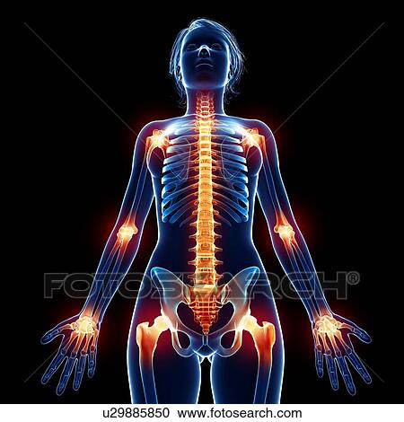 Clipart - Female skeleton, artwork. Fotosearch