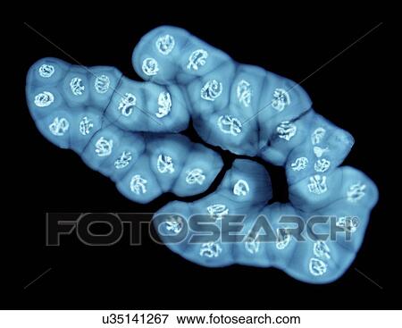 Giant chromosomes, light micrograph View Large Illustration Stock Illustration - Giant chromosomes, light micrograph. Fotosearch