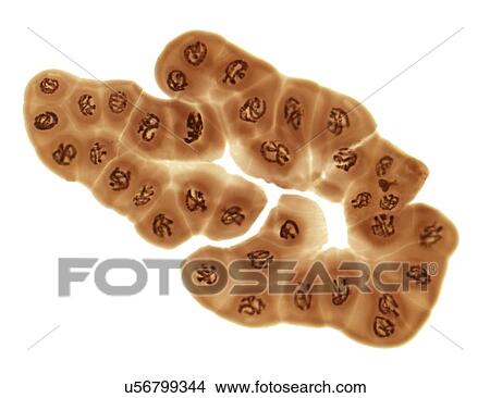 Stock Illustration - Giant chromosomes, light micrograph. Fotosearch