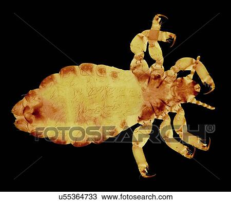 Drawing - Head louse, light micrograph. Fotosearch