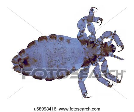 Head louse, light micrograph View Large Illustration Stock Illustration - Head louse, light micrograph. Fotosearch