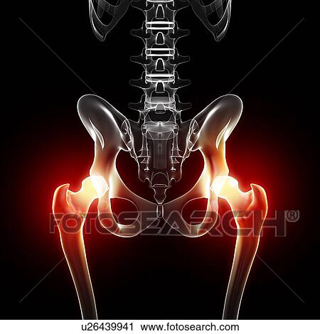 Hip pain, artwork View Large Illustration Clip Art - Hip pain, artwork. Fotosearch