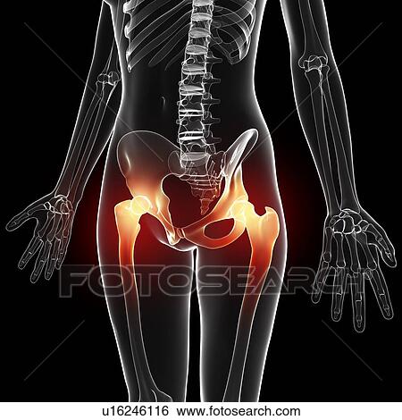 Hip pain, artwork View Large Illustration Stock Illustration - Hip pain, artwork. Fotosearch