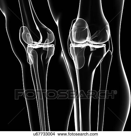 Human leg bones, artwork View Large Illustration Stock Illustration - Human leg bones, artwork. Fotosearch