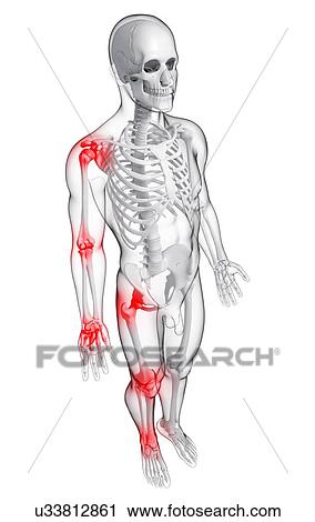 Joint pain, artwork View Large Illustration Clip Art - Joint pain, artwork. Fotosearch