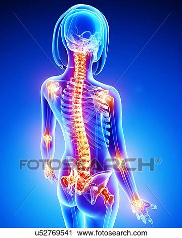 Joint pain, artwork View Large Illustration Clip Art - Joint pain, artwork. Fotosearch