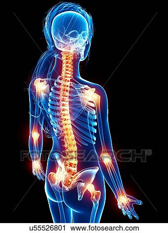 Joint pain, artwork View Large Illustration Clip Art - Joint pain, artwork. Fotosearch