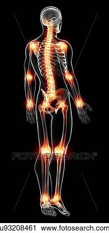 Joint pain, artwork View Large Illustration Clip Art - Joint pain, artwork. Fotosearch