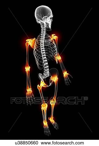 Clipart - Joint pain, artwork. Fotosearch