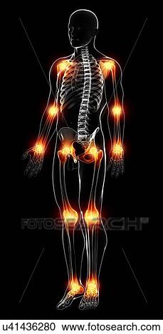Joint pain, artwork View Large Illustration Clipart - Joint pain, artwork. Fotosearch