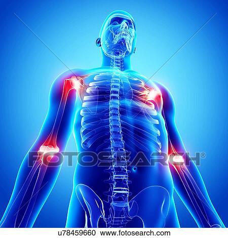 Joint pain, artwork View Large Illustration Clipart - Joint pain, artwork. Fotosearch