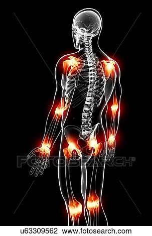 Joint pain, artwork View Large Illustration Drawing - Joint pain, artwork. Fotosearch