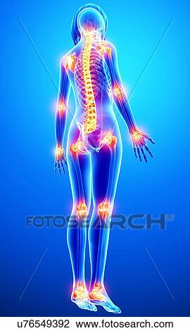 Joint pain, artwork View Large Illustration Drawing - Joint pain, artwork. Fotosearch