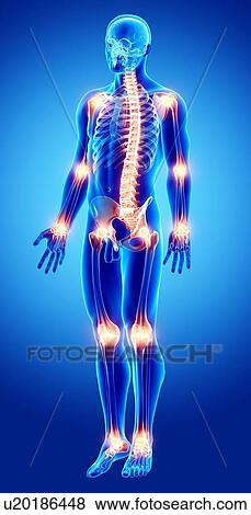 Joint pain, artwork View Large Illustration Stock Illustration - Joint pain, artwork. Fotosearch