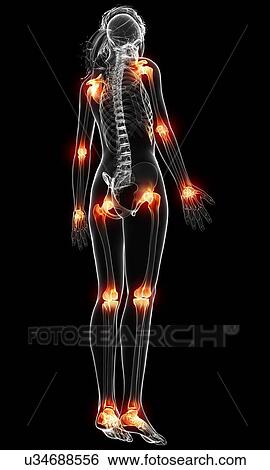 Stock Illustration - Joint pain, artwork. Fotosearch