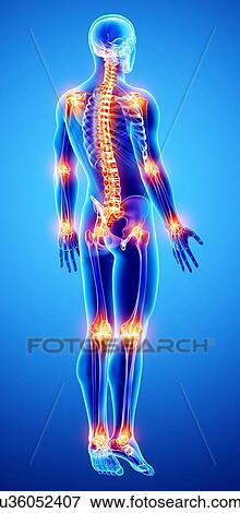 Joint pain, artwork View Large Illustration Stock Illustration - Joint pain, artwork. Fotosearch