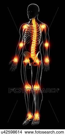 Joint pain, artwork View Large Illustration Stock Illustration - Joint pain, artwork. Fotosearch