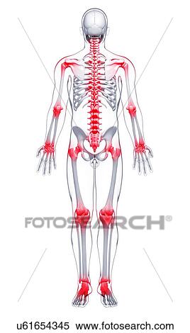 Joint pain, artwork View Large Illustration Stock Illustration - Joint pain, artwork. Fotosearch