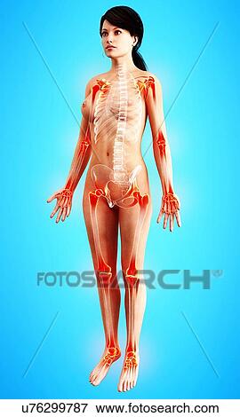 Joint pain, artwork View Large Illustration Stock Illustration - Joint pain, artwork. Fotosearch