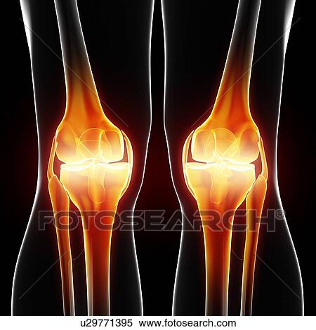 Knee pain, artwork View Large Illustration Stock Illustration - Knee pain, artwork. Fotosearch
