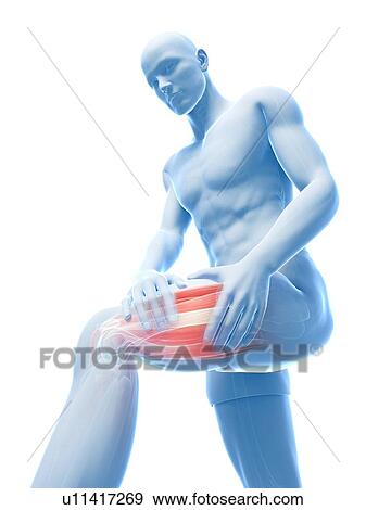 Stock Illustration - Leg cramp, artwork. Fotosearch