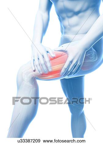 Stock Illustration - Leg cramp, artwork. Fotosearch