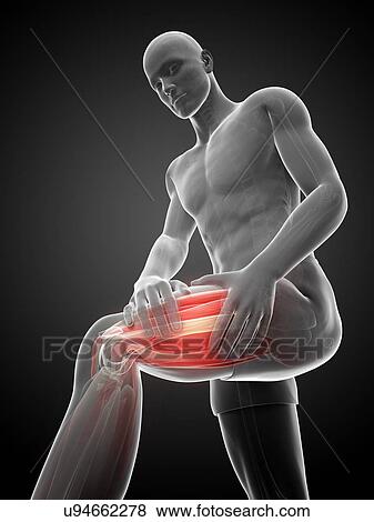 Stock Illustration - Leg cramp, artwork. Fotosearch