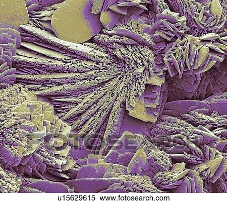 Limescale, SEM View Large Illustration Stock Illustration - Limescale, SEM. Fotosearch