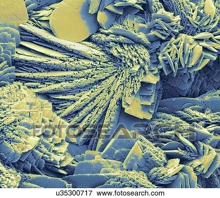 Limescale, SEM View Large Illustration Stock Illustration - Limescale, SEM. Fotosearch