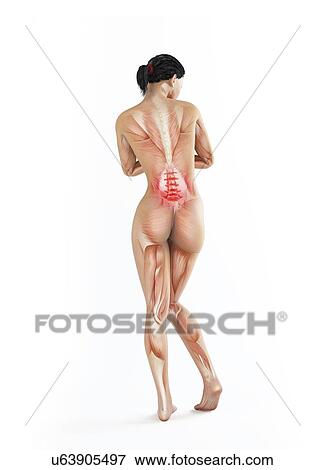 Lower back pain, conceptual artwork View Large Illustration Stock Illustration - Lower back pain, conceptual artwork. Fotosearch