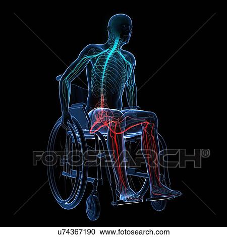 Clipart - Man in a wheelchair, artwork. Fotosearch