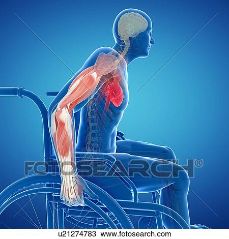 Drawing - Man in a wheelchair, artwork. Fotosearch