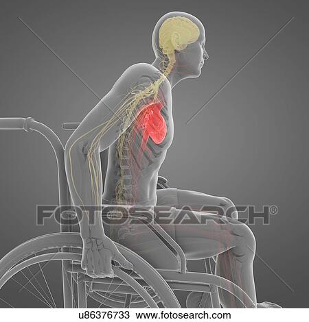 Drawing - Man in a wheelchair, artwork. Fotosearch
