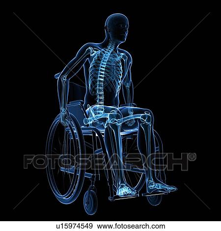 Man in a wheelchair, artwork View Large Illustration Stock Illustration - Man in a wheelchair, artwork. Fotosearch